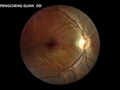 High Definition Imaging Ophthalmic Instrument Digital Portable Hand-held Eye Fun