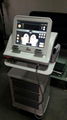 Non-invasive ultrasound HIFU system for