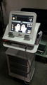 Non-invasive ultrasound HIFU system for wrinkle removal and skin lift