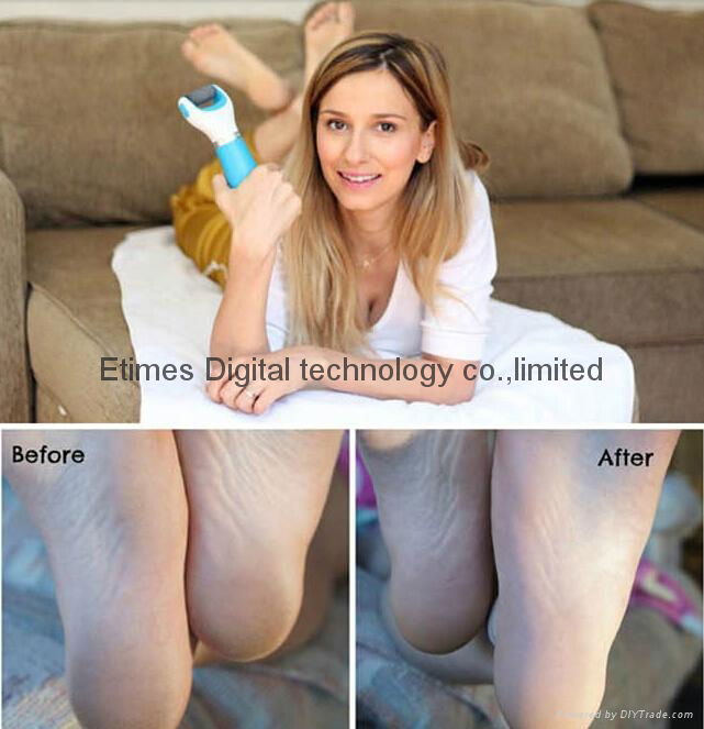 2015new Scholl Diamond Pink&Blue Feet Care Pedicure/Electric Foot File 5