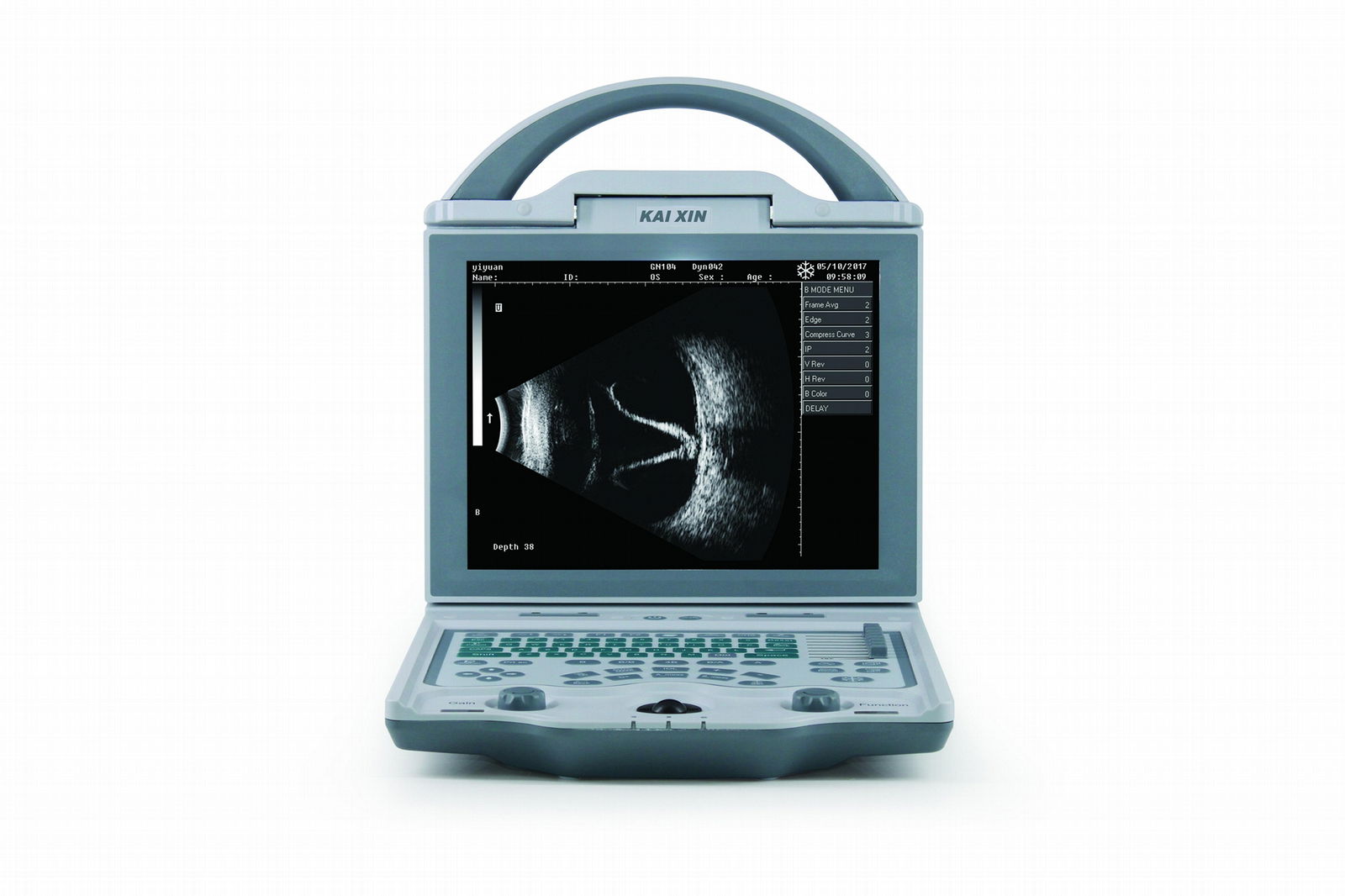 Ophthalmic A/B scan 2