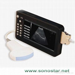 UPad-2掌上平板式超声显像诊断仪