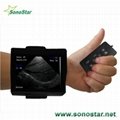 V2 Wrist Ultrasound Scanner