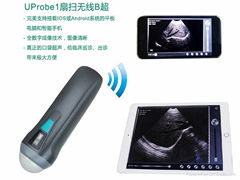 UProbe-1扇掃探頭式B超(無線傳輸到電腦顯示)