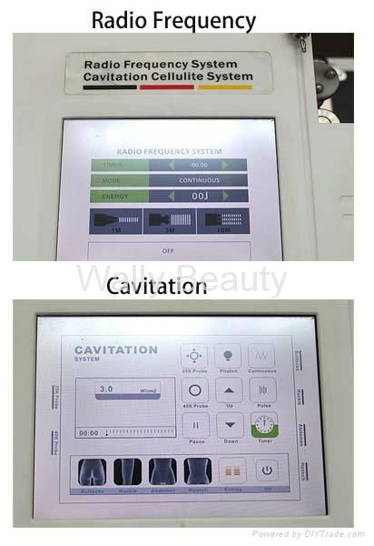 Cavitation slimming & RF skin lifting beauty equipment 4