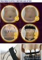 Laser slimming beauty equipment for shaping body 3