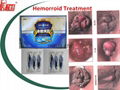 hemorrhoid gel natural remedies cure