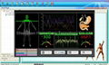 Newest Quantum Resonance Magnetic Analyzer 3