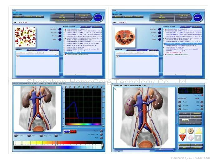 3D-NLS  health analyzer quantum analyzer English 3