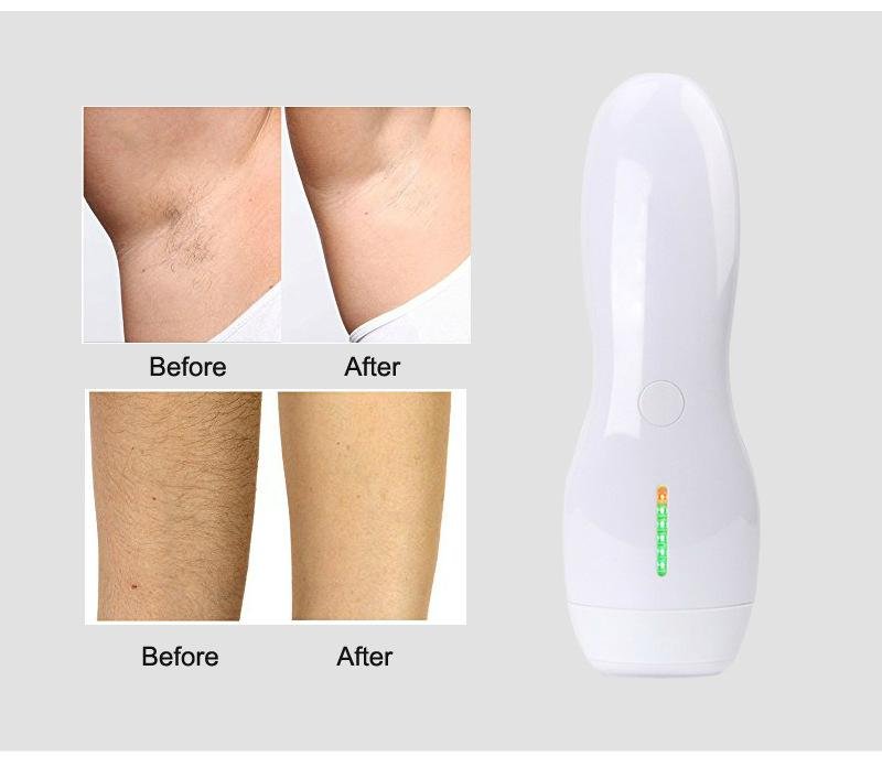 Household portable laser hair removal for women and man 4