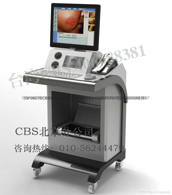 台湾cbs-809电子皮肤镜 1
