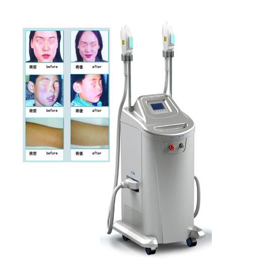 ipl laser hair removal machine with medical ce/iso - SMQ ...