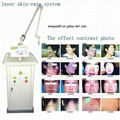 Q SWITCH Nd:YAG Laser Equipment Skin Care system Sincoheren 4