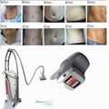 Kuma Shape mesotherapie slimming equipment 