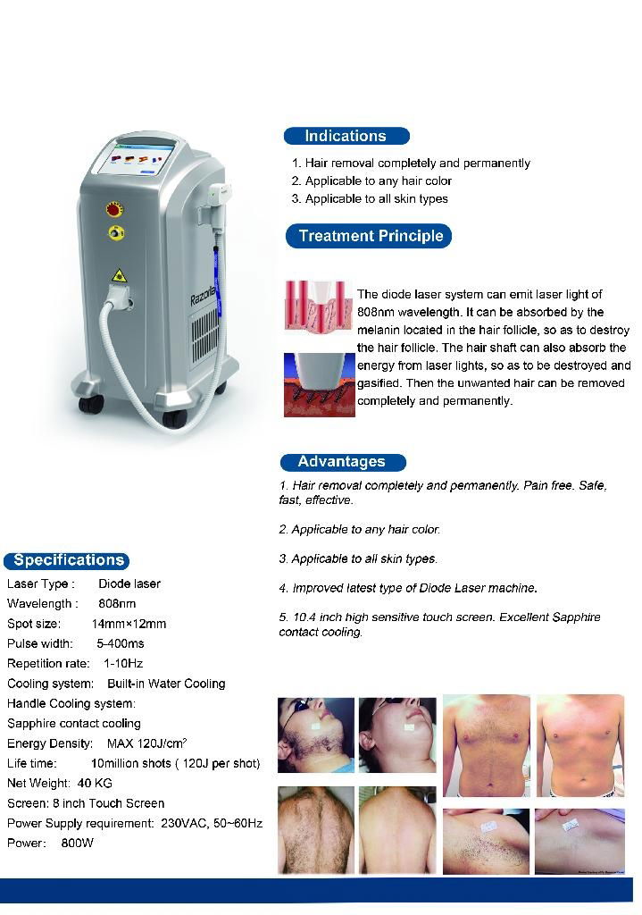 Medical CE approved high power 808nm Diode laser similar like lightsheer