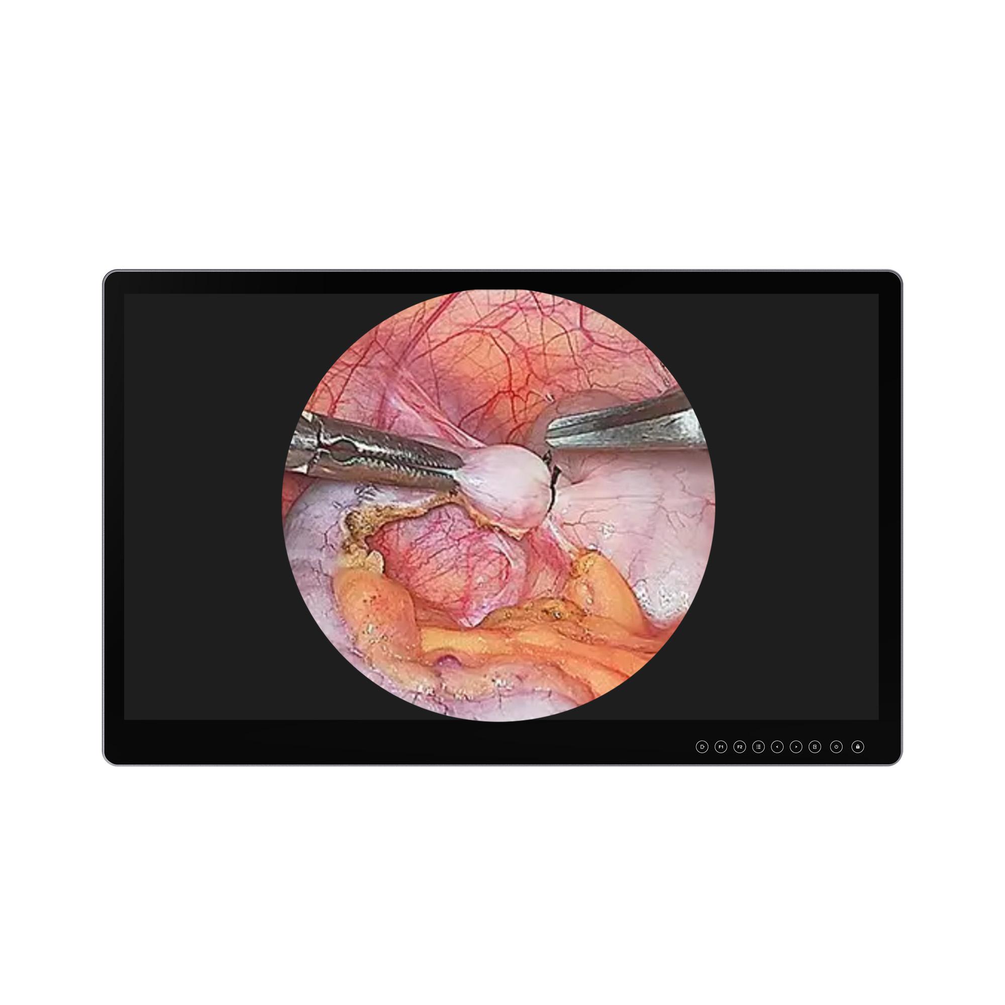 Surgical Monitor