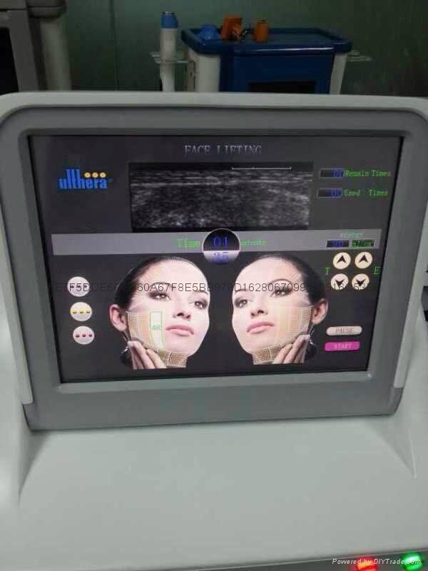 Hifu Wrinkle removal thermage beauty machine  3
