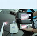 intraoral camera 4