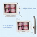 intraoral camera 4