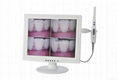 intraoral camera 1