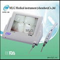 intraoral camera 1