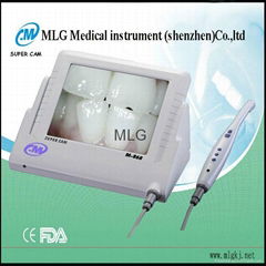 intraoral camera