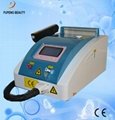 Q Switched nd Yag Laser Tattoo Removal 2
