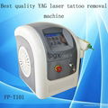 2015 Q-Switched ND YAG Laser Tattoo Removal Machine tattoo tattoo remover equip