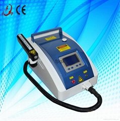 Q Switched nd Yag Laser Tattoo Removal