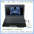 UB-7笔记本式孕妇检测