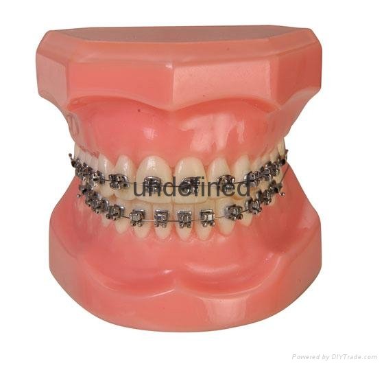 Top quality dental orthodontic bracket ,MBT ceramic brackets