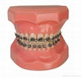 Top quality dental orthodontic bracket ,MBT ceramic brackets