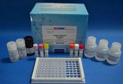 黃曲霉毒素M1檢測試劑盒