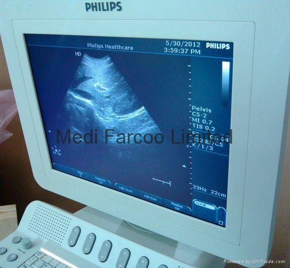Philip C5-2 Convex Ultrasound Transducer 2