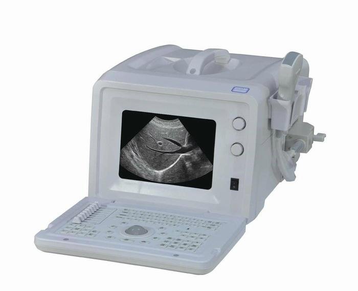 EXRH-300A Portable Type Ultrasound Scanner
