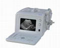 EXRH-300A Portable Type Ultrasound Scanner 1