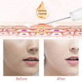 Ultrasonic Ion Therapy Face Skin Scrubber Facial Cleaner Cleansing Peeling+OEM