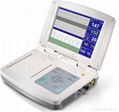 Mars K Fetal Monitor 2