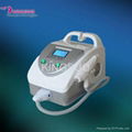 portable laser tattoo removal/q switch nd yag laser