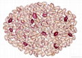 light speckled kidney bean- American