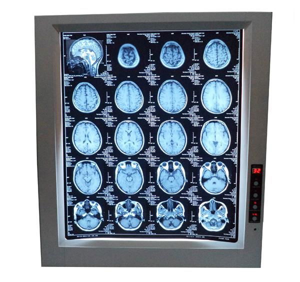 CEone panel LED x-ray film viewer 2