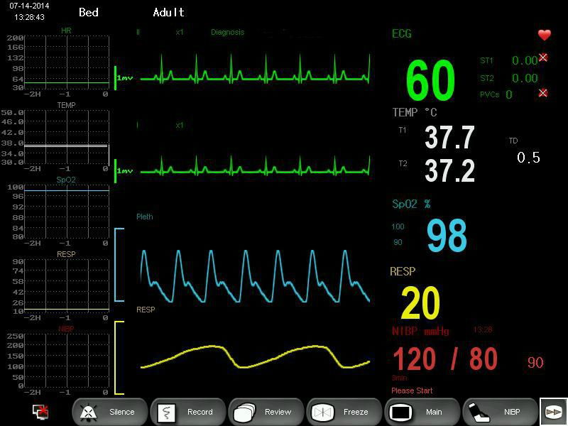 Motherboard for patient monitor 2