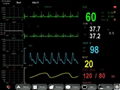 Motherboard for patient monitor