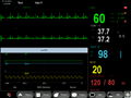 Motherboard for patient monitor