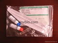 one step syphilis test (tp) chlamydia