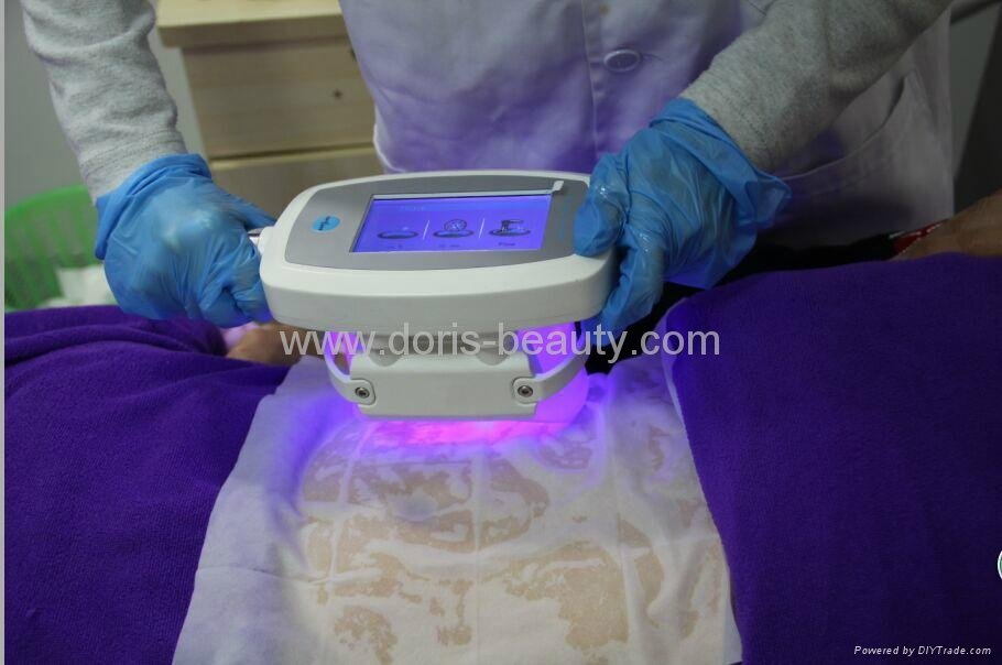 Dual handles Coolscuplting Cryolipolysis Fat Freezing Machine 2
