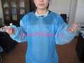 Water and blood resistance SMS disposable surgical gown 2