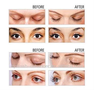 top selling products 2013/ FEG eyelash growth enhancer /100% herbal extract  3