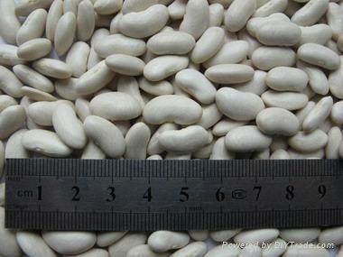 kidney beans 3
