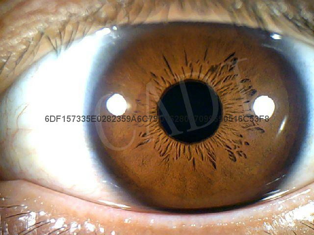 12MP CCD USB Iriscope – Diagnostic Eye Camera with 12MP HD 30x Iris Lens 3